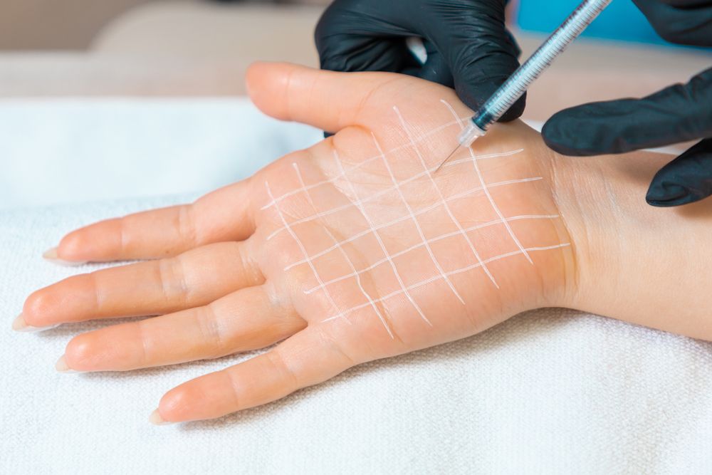 Bless Clinicの多汗症ボトックスが選ばれる理由